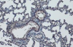 Anti-KLF4 antibody used in IHC (Paraffin sections) (IHC-P). GTX101508