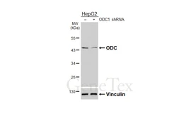 Anti-ODC antibody [N3C3] used in Western Blot (WB). GTX101521