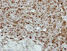 Anti-CRABP2 antibody [N1C3] used in IHC (Paraffin sections) (IHC-P). GTX101551