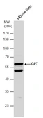 Anti-GPT antibody [N1N3] used in Western Blot (WB). GTX101559