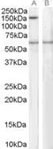 Anti-SIPA1 antibody, C-term used in Western Blot (WB). GTX10162