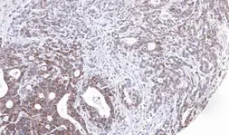 Anti-UBE2M antibody [N1C2] used in IHC (Paraffin sections) (IHC-P). GTX101653