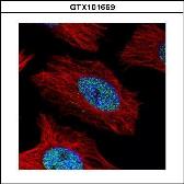 Anti-alpha Actinin 4 antibody [C2C3], C-term used in Immunocytochemistry/ Immunofluorescence (ICC/IF). GTX101669