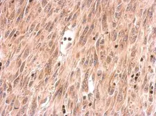 Anti-SOS2 antibody used in IHC (Paraffin sections) (IHC-P). GTX101723