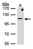 Anti-beta-Adaptin antibody [N3C1], Internal used in Western Blot (WB). GTX101753