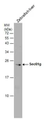 Anti-Sec61 gamma subunit antibody used in Western Blot (WB). GTX101782