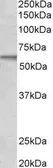 Anti-ACVRL1 antibody, C-term used in Western Blot (WB). GTX10179