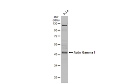 Anti-Actin Gamma 1 antibody used in Western Blot (WB). GTX101795