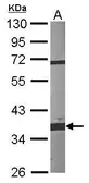 Anti-Fibrillarin antibody used in Western Blot (WB). GTX101807