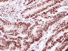 Anti-SNRPD2 antibody used in IHC (Paraffin sections) (IHC-P). GTX101846