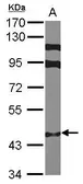 Anti-ZNF384 antibody [N1N2], N-term used in Western Blot (WB). GTX101975