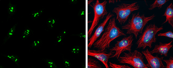 Anti-PAF49 antibody used in Immunocytochemistry/ Immunofluorescence (ICC/IF). GTX102175