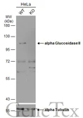 Anti-alpha Glucosidase II antibody [C2C3], C-term used in Western Blot (WB). GTX102205