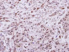 Anti-DPF2 antibody used in IHC (Paraffin sections) (IHC-P). GTX102235
