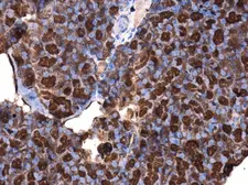 Anti-CDC25A antibody used in IHC (Paraffin sections) (IHC-P). GTX102308