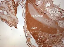 Anti-Calpain 1 antibody used in IHC (Paraffin sections) (IHC-P). GTX102350