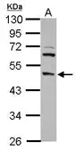 Anti-DP2 antibody [N2C1], Internal used in Western Blot (WB). GTX102365