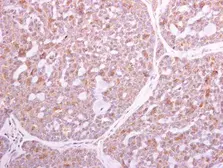 Anti-TLR2 antibody [N1N2], N-term used in IHC (Paraffin sections) (IHC-P). GTX102577
