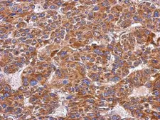 Anti-Integrin alpha 9 antibody [N1N2], N-term used in IHC (Paraffin sections) (IHC-P). GTX102728