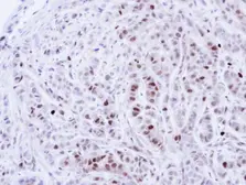Anti-NEK4 antibody [N2C1], Internal used in IHC (Paraffin sections) (IHC-P). GTX102826
