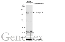 Anti-Collagen III antibody [C2C3], C-term used in Western Blot (WB). GTX102997
