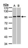 Anti-IL12 Receptor beta2 antibody [N3C2], Internal used in Western Blot (WB). GTX103166