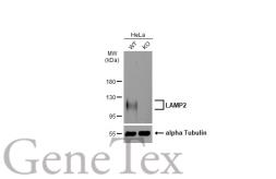Anti-LAMP2 antibody used in Western Blot (WB). GTX103214