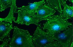 Anti-alpha Actinin 2 antibody [N1N3] used in Immunocytochemistry/ Immunofluorescence (ICC/IF). GTX103219