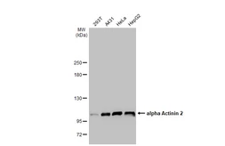 Anti-alpha Actinin 2 antibody [N1N3] used in Western Blot (WB). GTX103219