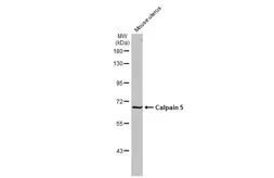 Anti-Calpain 5 antibody [N1C1] used in Western Blot (WB). GTX103264