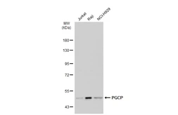 Anti-PGCP antibody used in Western Blot (WB). GTX103290