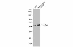 Anti-c-Myc antibody used in Western Blot (WB). GTX103436