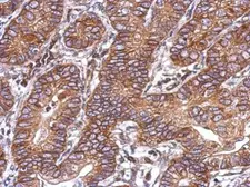 Anti-Activin Receptor Type IC antibody used in IHC (Paraffin sections) (IHC-P). GTX103442