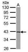 Anti-UROD antibody [N3C3] used in Western Blot (WB). GTX103610