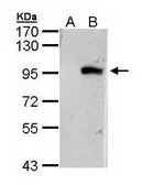 Anti-ECEL1 antibody [N3C2], Internal used in Western Blot (WB). GTX103771