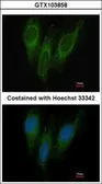 Anti-DNAJC1 antibody [C1C3] used in Immunocytochemistry/ Immunofluorescence (ICC/IF). GTX103858