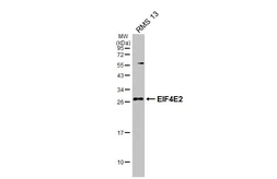 Anti-EIF4E2 antibody [N1C3] used in Western Blot (WB). GTX103977