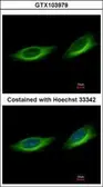 Anti-TULP1 antibody [C1C3] used in Immunocytochemistry/ Immunofluorescence (ICC/IF). GTX103979