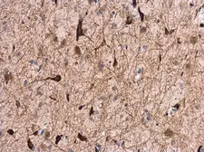 Anti-GABA A Receptor alpha 1 antibody [N1C1] used in IHC (Paraffin sections) (IHC-P). GTX104027