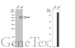 Anti-GI24 antibody used in Western Blot (WB). GTX104081