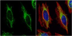 Anti-Cytokeratin 14 antibody used in Immunocytochemistry/ Immunofluorescence (ICC/IF). GTX104124