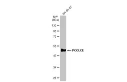 Anti-PCOLCE antibody [N1C3] used in Western Blot (WB). GTX104154