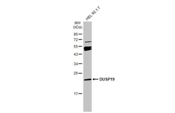 Anti-DUSP19 antibody used in Western Blot (WB). GTX104197