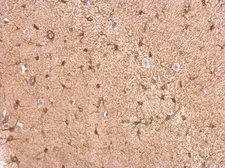Anti-GPBB antibody used in IHC (Paraffin sections) (IHC-P). GTX104291