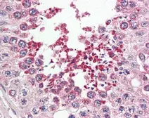 Anti-IRAK1BP1 antibody [N1C3] used in IHC (Paraffin sections) (IHC-P). GTX104392