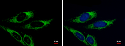 Anti-Adenylate kinase 4 antibody [N1C3] used in Immunocytochemistry/ Immunofluorescence (ICC/IF). GTX104430
