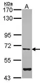 Anti-Arylsulfatase G antibody [N2C2], Internal used in Western Blot (WB). GTX104431