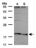 Anti-SCN3B antibody [N1C3] used in Western Blot (WB). GTX104440
