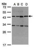 Anti-DNAJC17 antibody [N1C2] used in Western Blot (WB). GTX104456