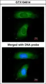 Anti-BLNK antibody [C3], C-term used in Immunocytochemistry/ Immunofluorescence (ICC/IF). GTX104614